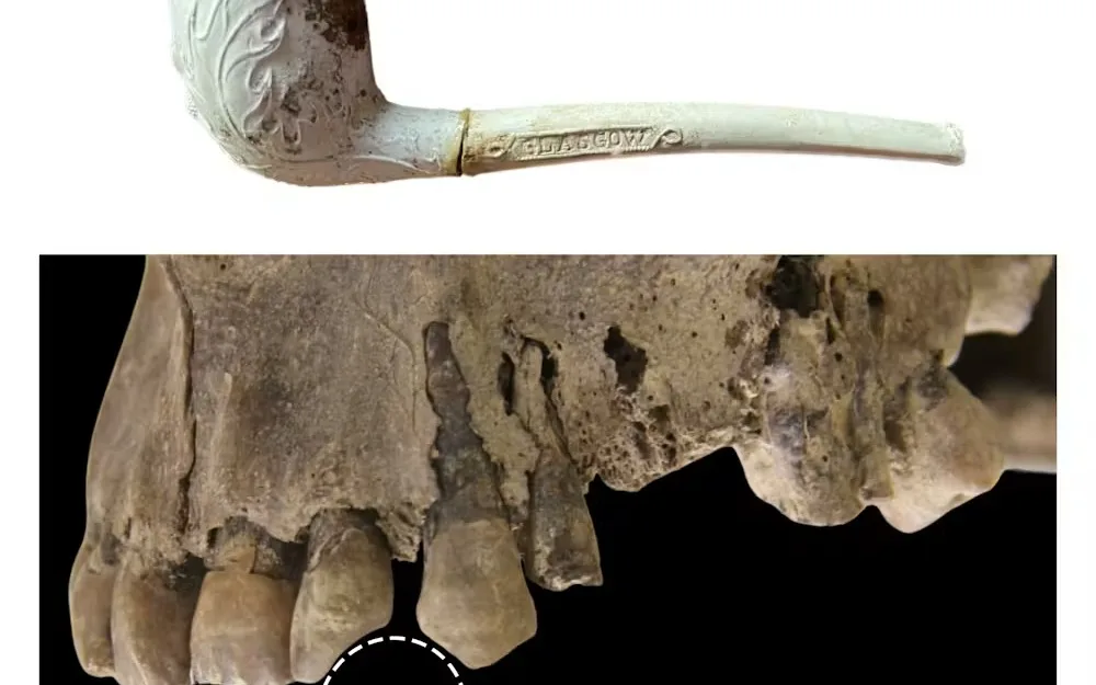 Top: historical clay pipe. Bottom: rounded notch (clay pipe facet) formed in the teeth of a habitual clay pipe smoker (~1860–1920 CE)